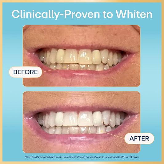 Lumineux 2-in-1 Stain Prevention Teeth Whitening Pen