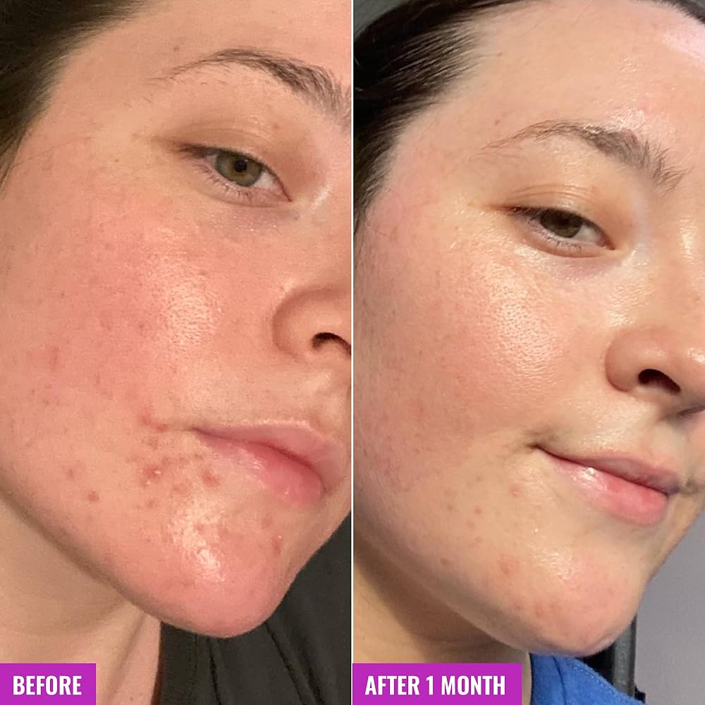 Good Molecules Clarifying Soap-Free Cleansing Bar