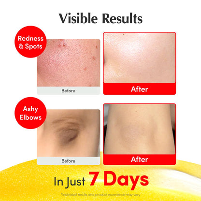 EQQUALBERRY Niacinamide 4% & Vitamin C Acerola Illuminating Face Serum