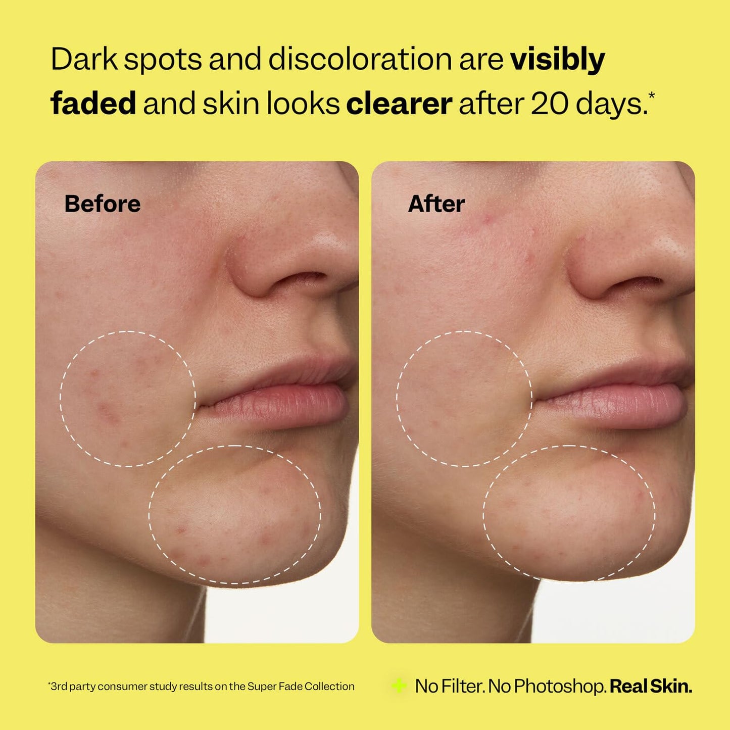 Peach Slices Super Fade Tranexamic Acid & Niacinamide Dark Spot Serum