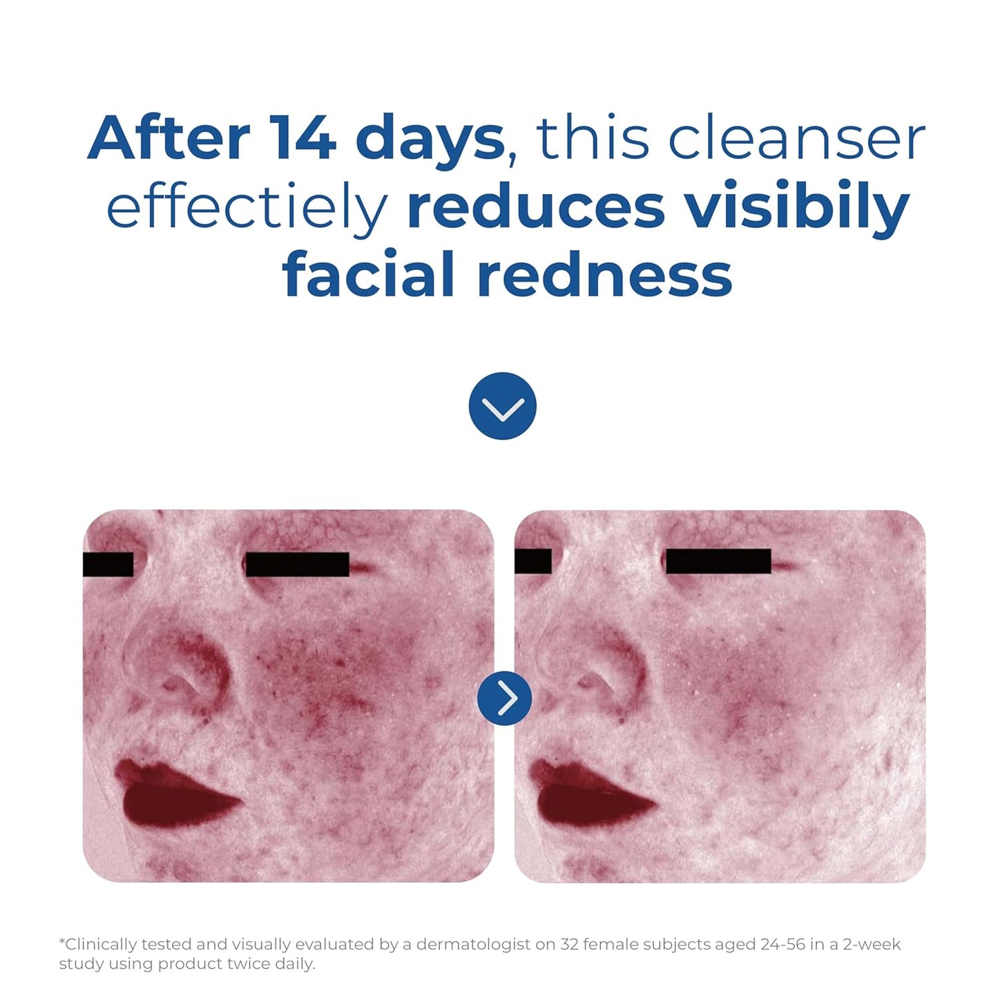 EltaMD Skin Recovery Amino Acid Foaming Cleanser for Sensitive Skin