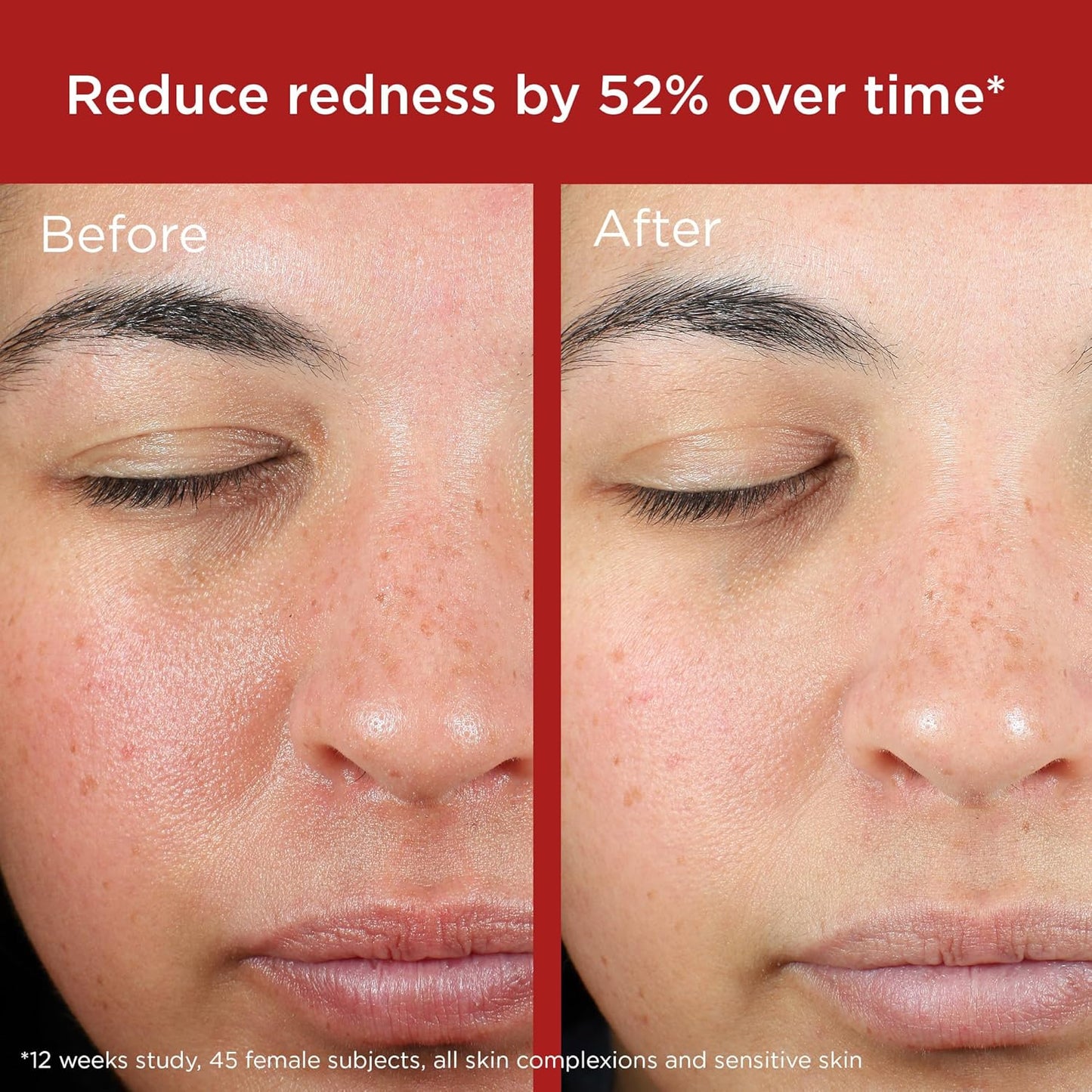 EltaMD UV Skin Recovery Mineral Zinc Oxide SPF 50 Face Sunscreen