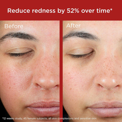 EltaMD UV Skin Recovery Mineral Zinc Oxide SPF 50 Face Sunscreen
