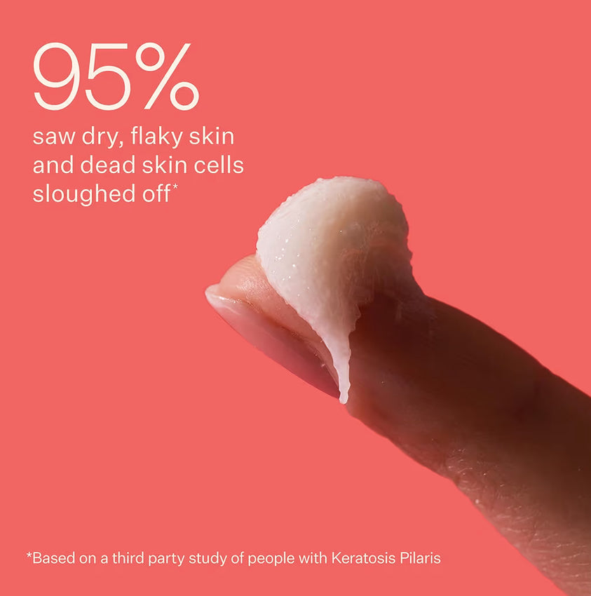 Peach & Lily KP Bump Boss AHA Microdermabrasion Body Scrub