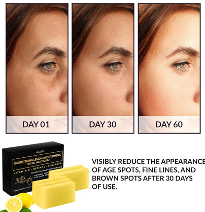 VALITIC Lemon, Turmeric & Kojic Acid Brightening Soap with Vitamin C & Retinol – 2 Pack