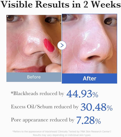 Medicube Zero Pore Pad 2.0 with BHA, AHA & Lavender Toner Pads