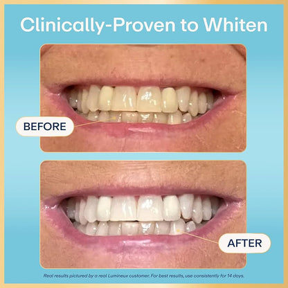 Lumineux 2-in-1 Stain Prevention Teeth Whitening Pen
