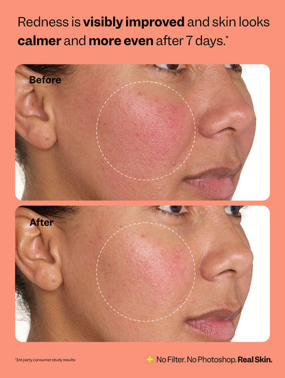 Peach Slices Fix All Multi-Action Recovery Face Mist