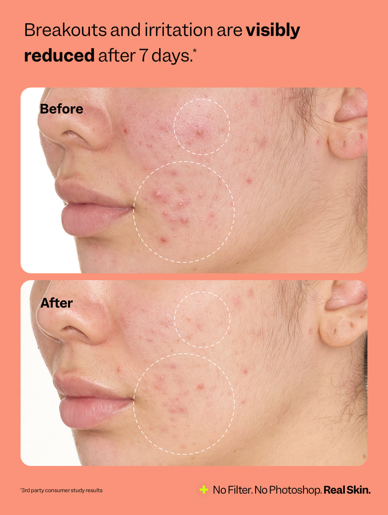 Peach Slices Fix All Multi-Action Recovery Face Mist