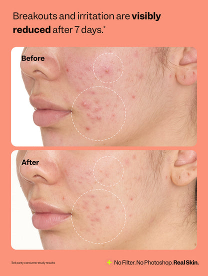 Peach Slices Fix All Multi-Action Recovery Face Mist