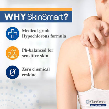 SkinSmart Antimicrobial Eczema Therapy with Hypochlorous Acid