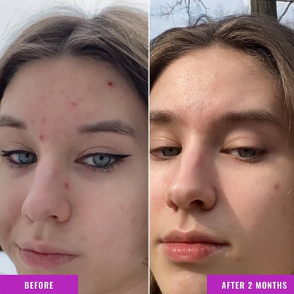 Good Molecules Niacinamide 10% Pore-Refining Serum
