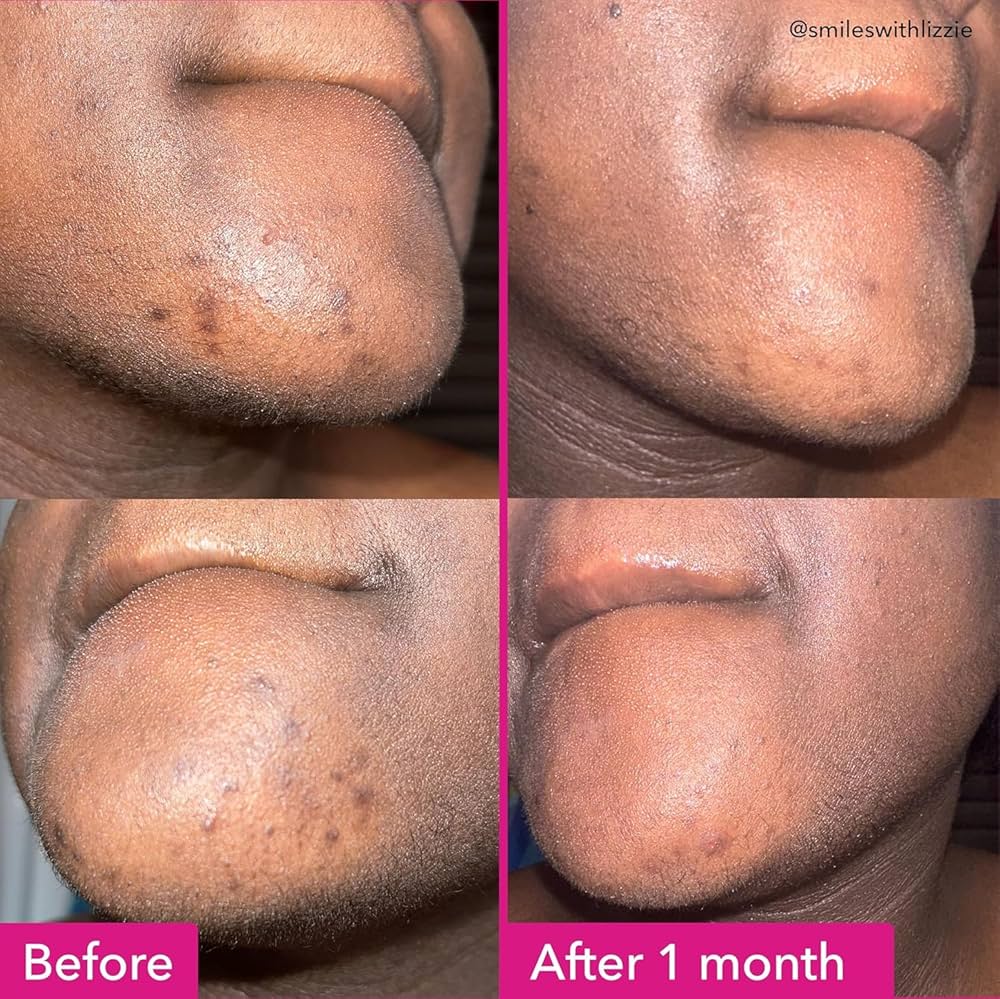 Good Molecules Brightening Dark Spot Cleansing Bar