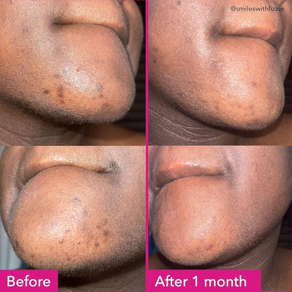Good Molecules Brightening Dark Spot Cleansing Bar