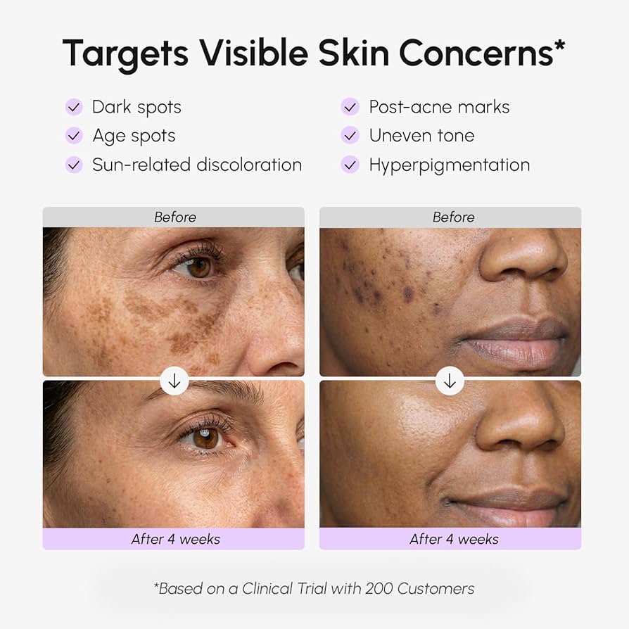 MAREE Dark Spot Corrector Serum for Face & Body