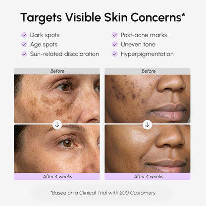 MAREE Dark Spot Corrector Serum for Face & Body