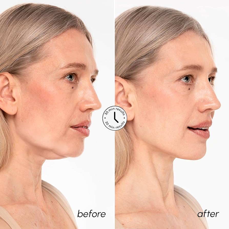 MAREE 24K Gold V-Line Jawline Lifting Mask