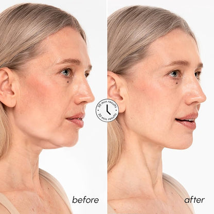 MAREE 24K Gold V-Line Jawline Lifting Mask